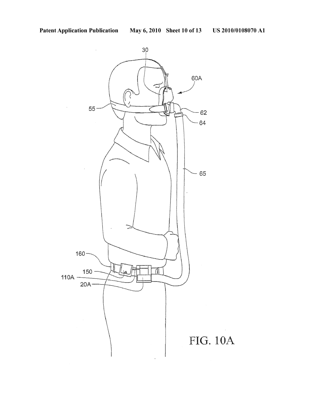 VENTILATOR MASK AND SYSTEM - diagram, schematic, and image 11