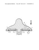 SURGICAL STAPLER diagram and image