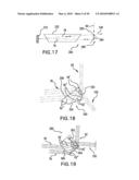 Laser system diagram and image