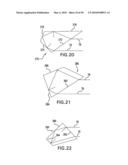 Laser system diagram and image