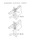 Stroller with Synchronized Seat Height Adjustment diagram and image