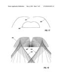 Compact Led Downlight with cuspated flux-redistribution lens diagram and image