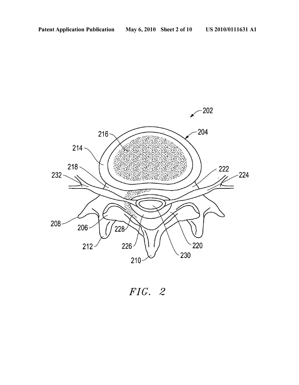 Tool for Finishing the Ends of Surgical Rods and Methods of Use - diagram, schematic, and image 03