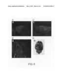 BRAIN-LOCALIZING POLYPEPTIDES COMPRISING A MULTIVALENT BINDING MOIETY AND IMPROVED METABOLIC STABILITY diagram and image