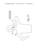 Human sample matching system diagram and image