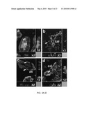 Induction of Renal Cells for Treatment of Kidney Disease diagram and image