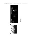 Induction of Renal Cells for Treatment of Kidney Disease diagram and image