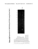 NUCLEIC ACID AND CORRESPONDING PROTEIN ENTITLED 193P1E1B USEFUL IN TREATMENT AND DETECTION OF CANCER diagram and image