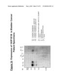 NUCLEIC ACID AND CORRESPONDING PROTEIN ENTITLED 193P1E1B USEFUL IN TREATMENT AND DETECTION OF CANCER diagram and image