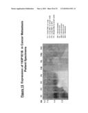 NUCLEIC ACID AND CORRESPONDING PROTEIN ENTITLED 193P1E1B USEFUL IN TREATMENT AND DETECTION OF CANCER diagram and image