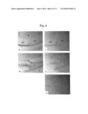 METHODS OF TREATING NEUROLOGICAL CONDITIONS WITH HEMATOPOEITIC GROWTH FACTORS diagram and image