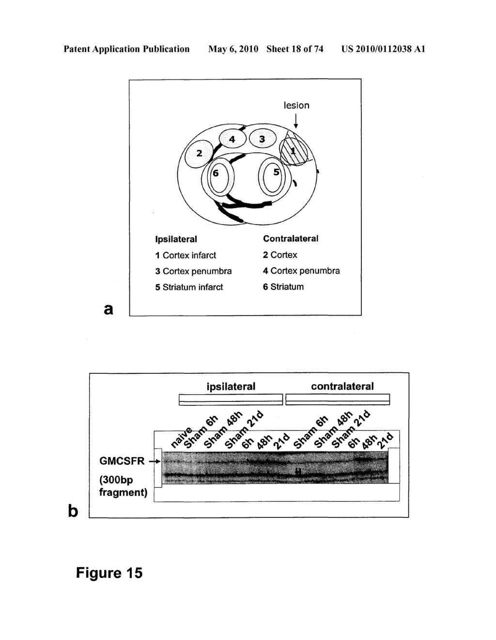 METHODS OF TREATING NEUROLOGICAL CONDITIONS WITH HEMATOPOEITIC GROWTH FACTORS - diagram, schematic, and image 19