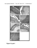 METHODS OF TREATING NEUROLOGICAL CONDITIONS WITH HEMATOPOEITIC GROWTH FACTORS diagram and image