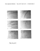 METHODS OF TREATING NEUROLOGICAL CONDITIONS WITH HEMATOPOEITIC GROWTH FACTORS diagram and image