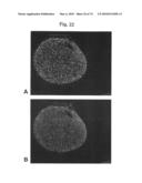 METHODS OF TREATING NEUROLOGICAL CONDITIONS WITH HEMATOPOEITIC GROWTH FACTORS diagram and image