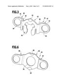 EXPANSION SCREW FOR REGULATING TEETH diagram and image