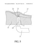 VIBRATIONAL FILLING DEVICE FOR IMPLANTING TOOTH BONE POWDER diagram and image