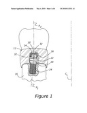 DENTAL ABUTMENT ANALOG FOR IMPLANT-SECURED RESTORATION diagram and image