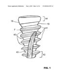 CONDENSING SKELETAL IMPLANT THAT FACILITATE INSERTIONS diagram and image