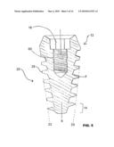 CONDENSING SKELETAL IMPLANT THAT FACILITATE INSERTIONS diagram and image