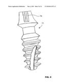 CONDENSING SKELETAL IMPLANT THAT FACILITATE INSERTIONS diagram and image