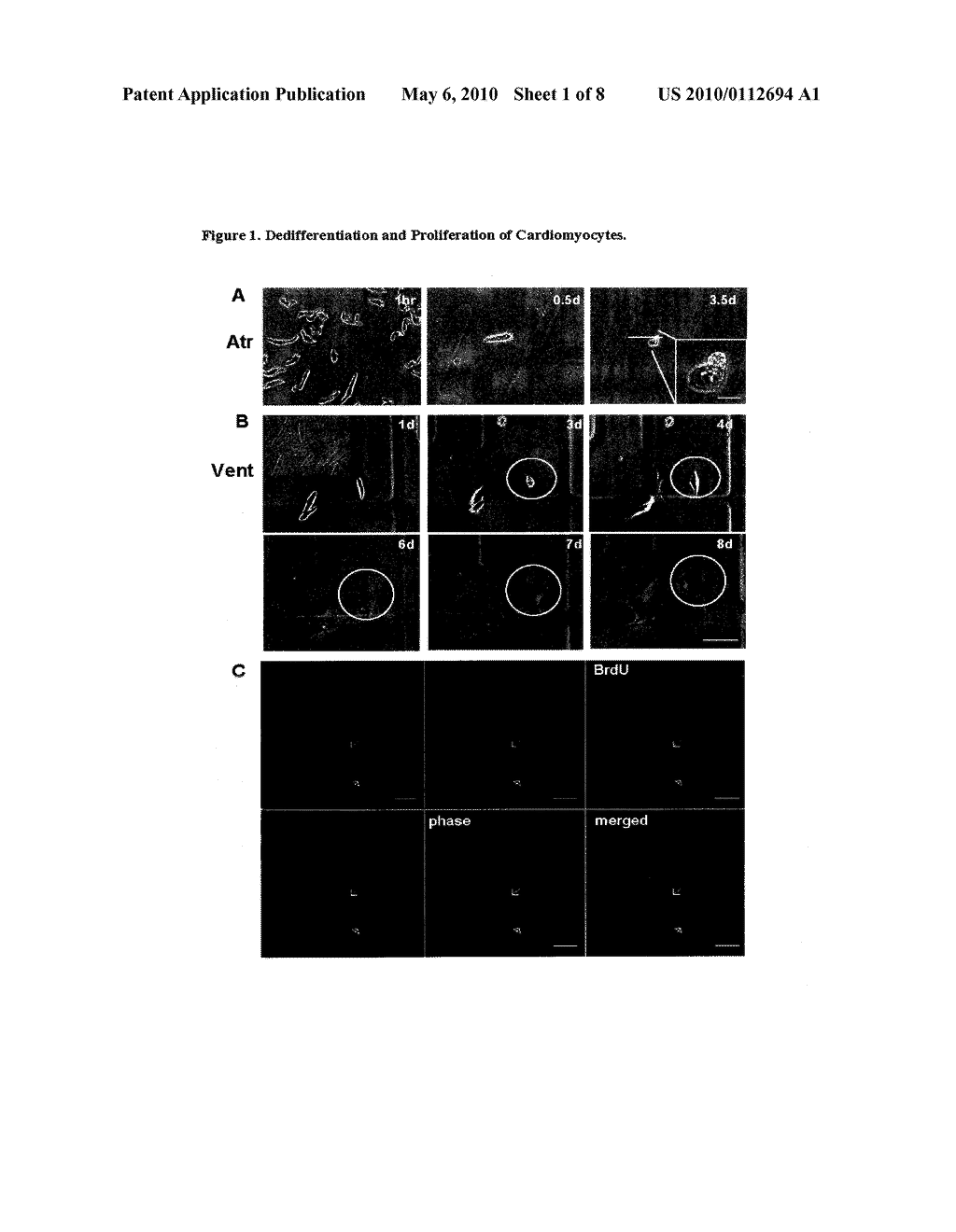 Dedifferentiation of Adult Mammalian Cardiomyocytes into Cardiac Stem Cells - diagram, schematic, and image 02