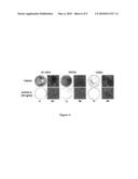 METHODS FOR CONTROLLING MINERALIZATION OF EXTRACELLULAR MATRIX, THERAPEUTIC METHODS BASED THEREON AND MEDICAMENTS FOR USE THEREIN diagram and image