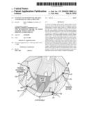 SYSTEMS AND METHODS FOR TREATING ANTERIOR PELVIC ORGAN PROLAPSE diagram and image