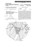 SYSTEMS AND METHODS FOR TREATING POSTERIOR PELVIC ORGAN PROLAPSE diagram and image