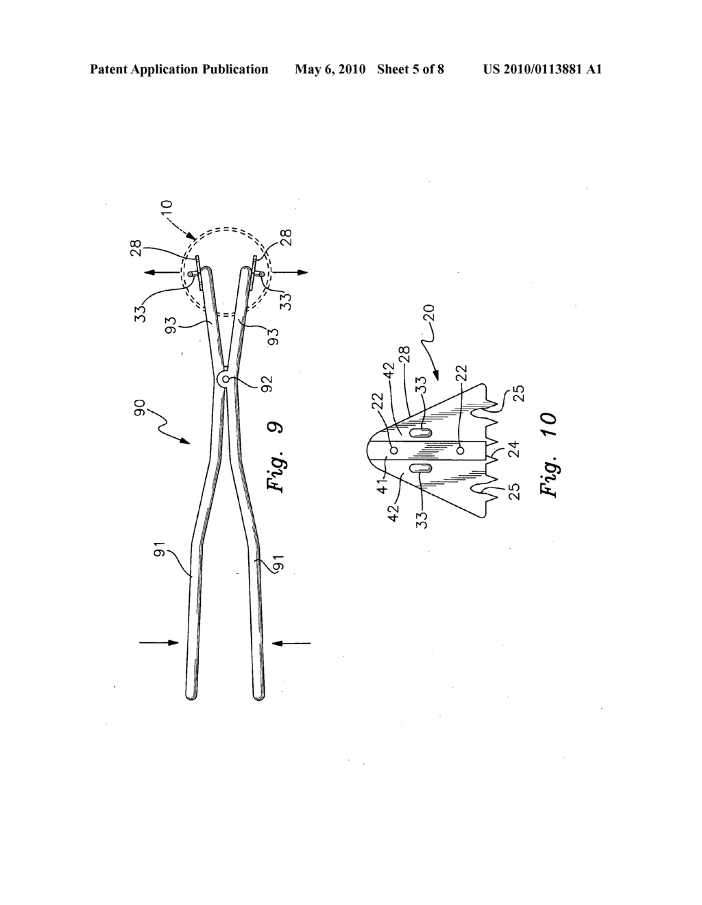 Surgical retractor extensions - diagram, schematic, and image 06