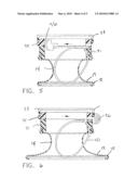 SURGICAL ACCESS PORT WITH ADJUSTABLE RING GEOMETRY diagram and image