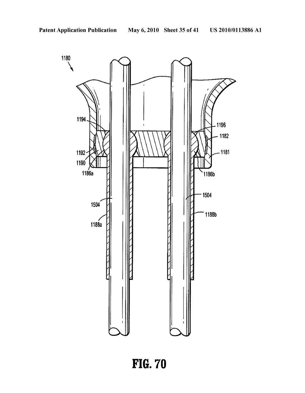 SURGICAL PORT ASSEMBLY - diagram, schematic, and image 36