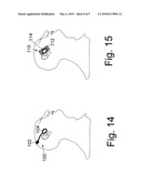 METHODS AND DEVICES FOR MEASURING CORE BODY TEMPERATURE diagram and image