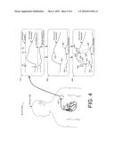 INTERPOLATING LEFT VENTRICULAR PRESSURES diagram and image