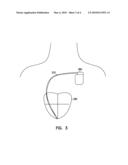 SYSTEM FOR VERIFYING THE INTEGRITY OF CARDIAC COMPLEX TEMPLATES diagram and image