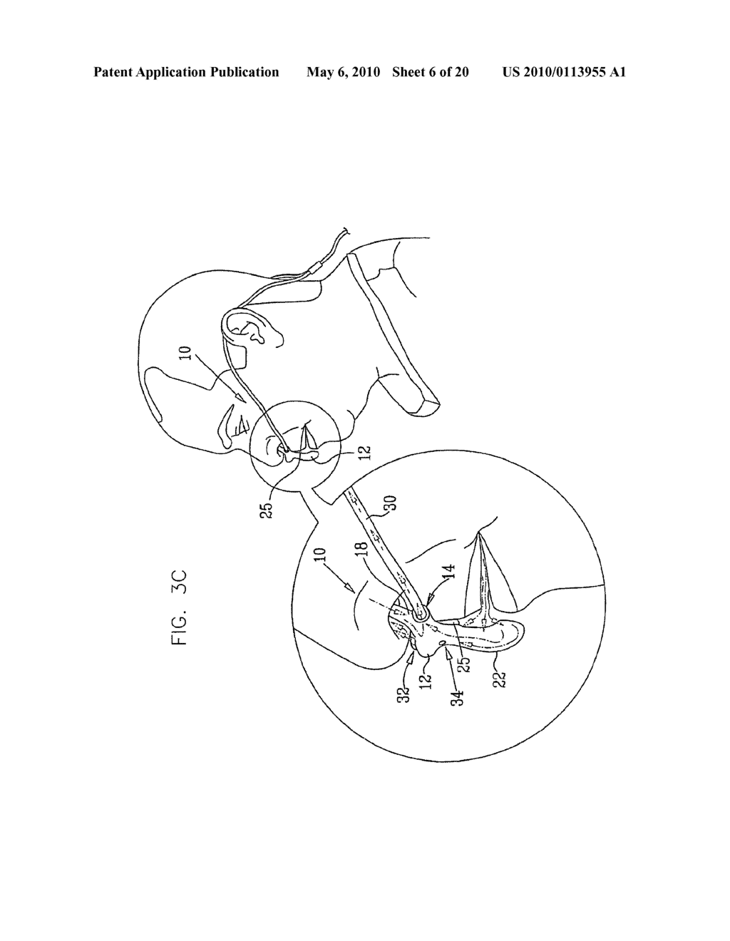 ORAL-NASAL CANNULA SYSTEM ENABLING CO2 AND BREATH FLOW MEASUREMENT - diagram, schematic, and image 07