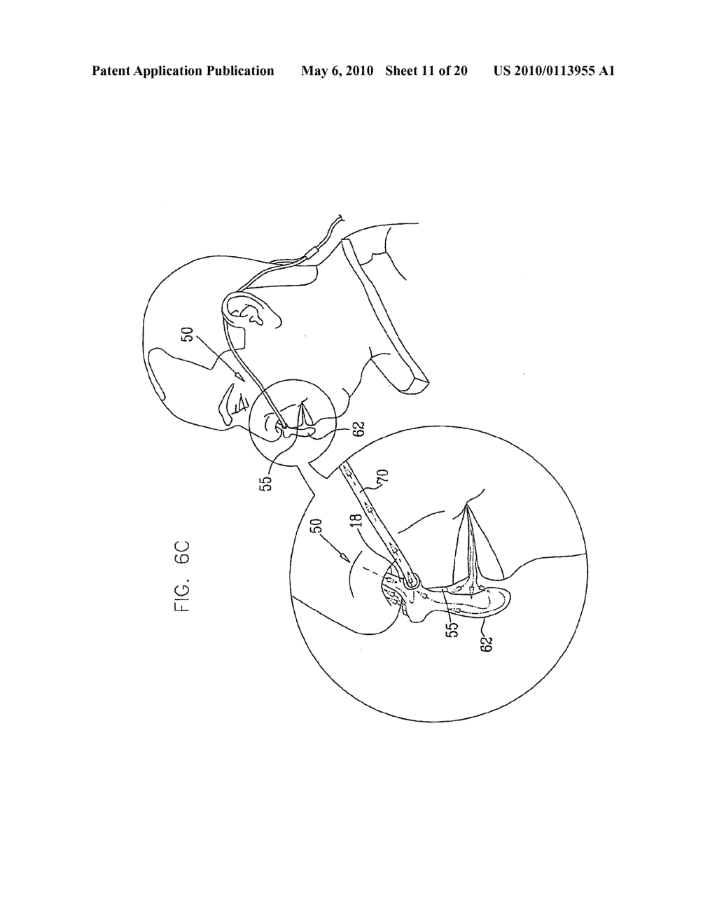 ORAL-NASAL CANNULA SYSTEM ENABLING CO2 AND BREATH FLOW MEASUREMENT - diagram, schematic, and image 12