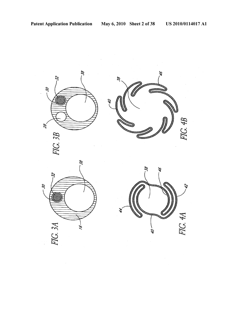 SYSTEMS AND METHODS FOR REMOVING OBSTRUCTIVE MATTER FROM BODY LUMENS AND TREATING VASCULAR DEFECTS - diagram, schematic, and image 03