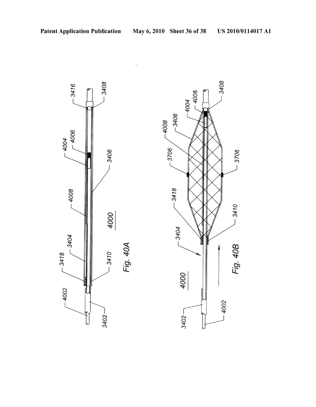SYSTEMS AND METHODS FOR REMOVING OBSTRUCTIVE MATTER FROM BODY LUMENS AND TREATING VASCULAR DEFECTS - diagram, schematic, and image 37