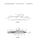 DEFLATABLE BIFURCATED DEVICE diagram and image