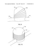 DEFLATABLE BIFURCATED DEVICE diagram and image