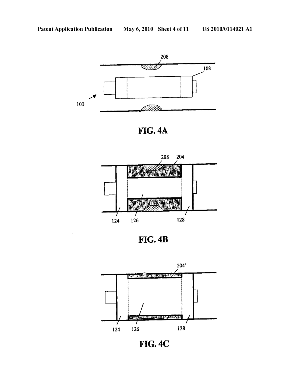 MULTI-FUNCTION CATHETER AND USE THEREOF - diagram, schematic, and image 05