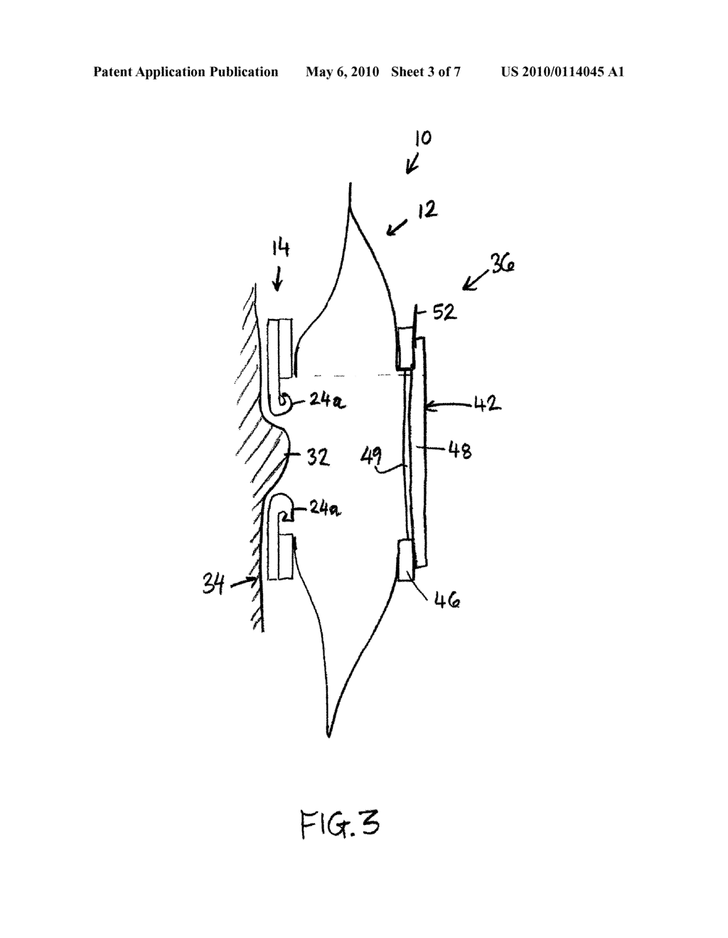 OSTOMY POUCH APPLIANE - diagram, schematic, and image 04