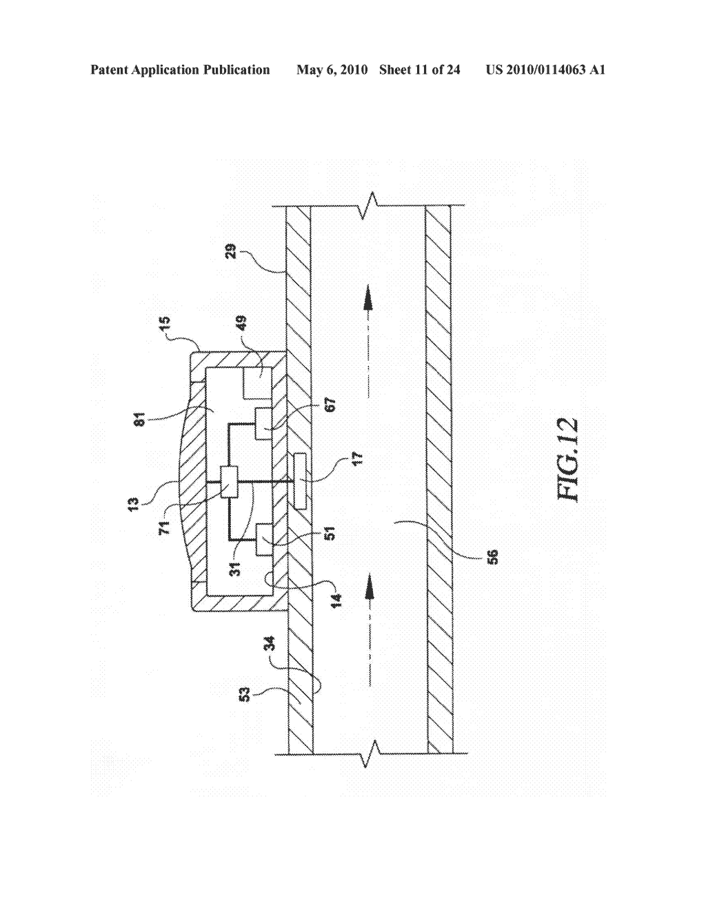 CATHETER INJECTION MONITORING DEVICE - diagram, schematic, and image 12