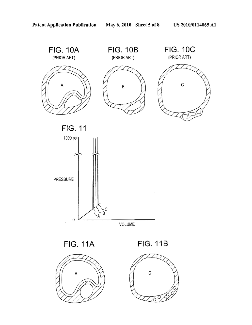 DRUG DELIVERY SHOCKWAVE BALLOON CATHETER SYSTEM - diagram, schematic, and image 06