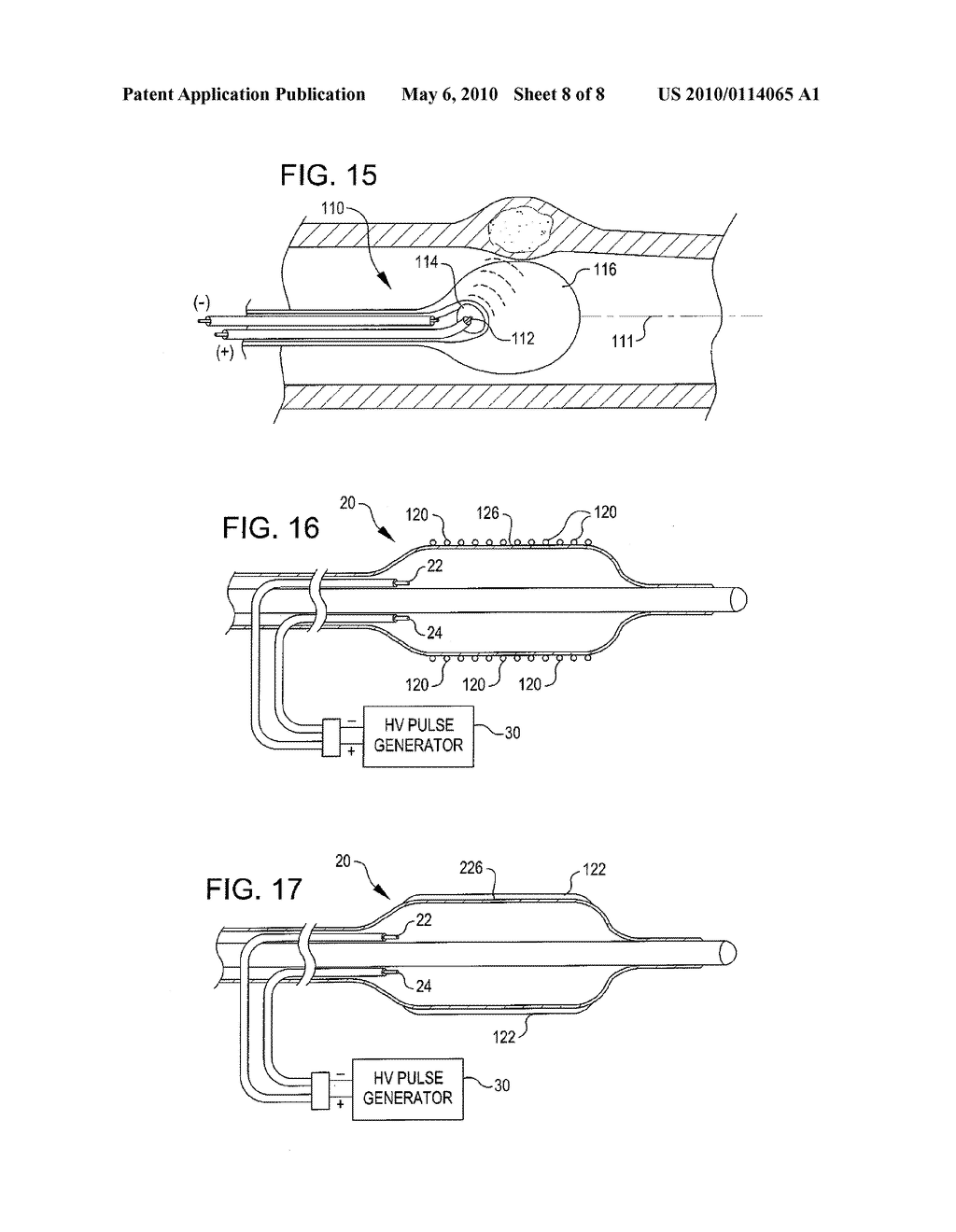 DRUG DELIVERY SHOCKWAVE BALLOON CATHETER SYSTEM - diagram, schematic, and image 09