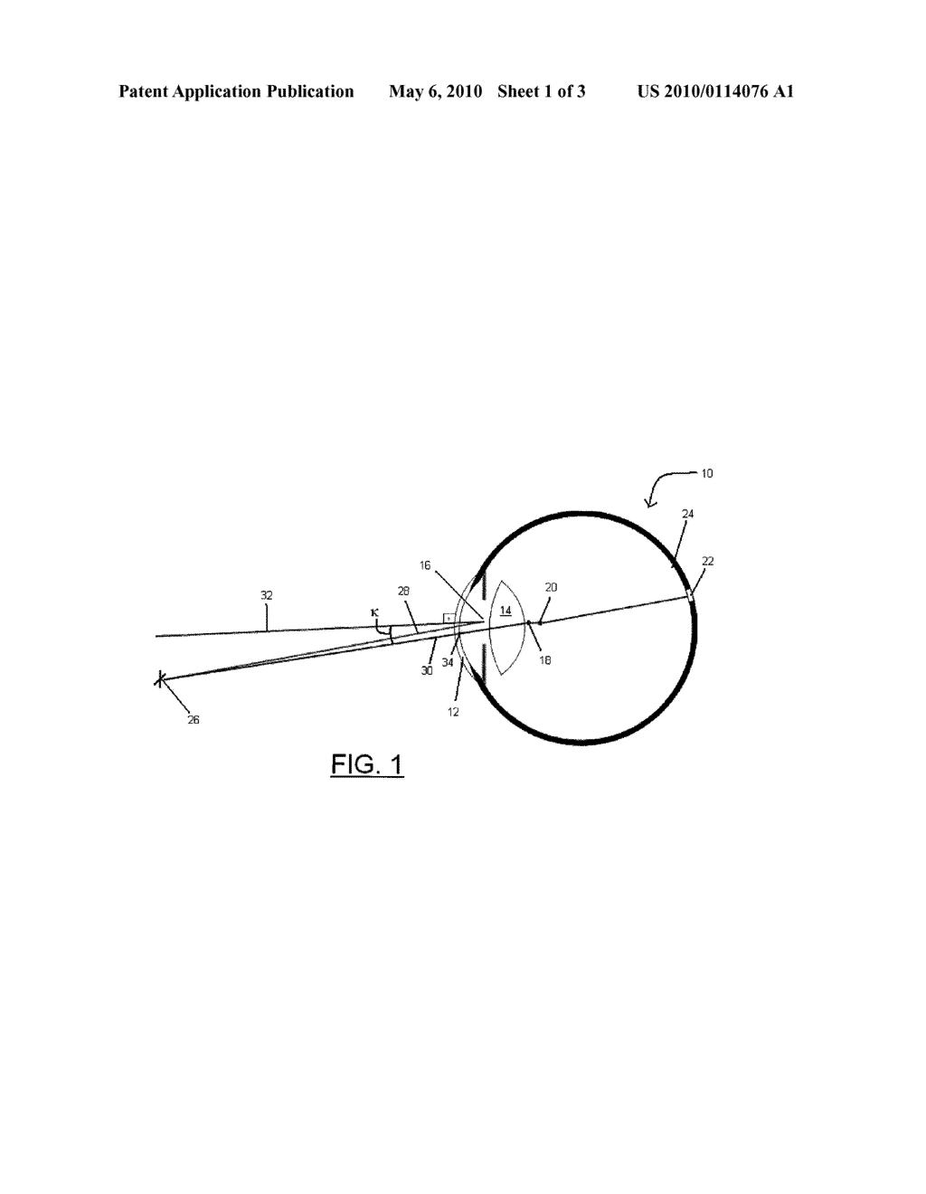 METHOD OF PERFORMING REFRACTIVE LASER EYE SURGERY CENTERED ALONG THE VISUAL AXIS OF A HUMAN EYE - diagram, schematic, and image 02