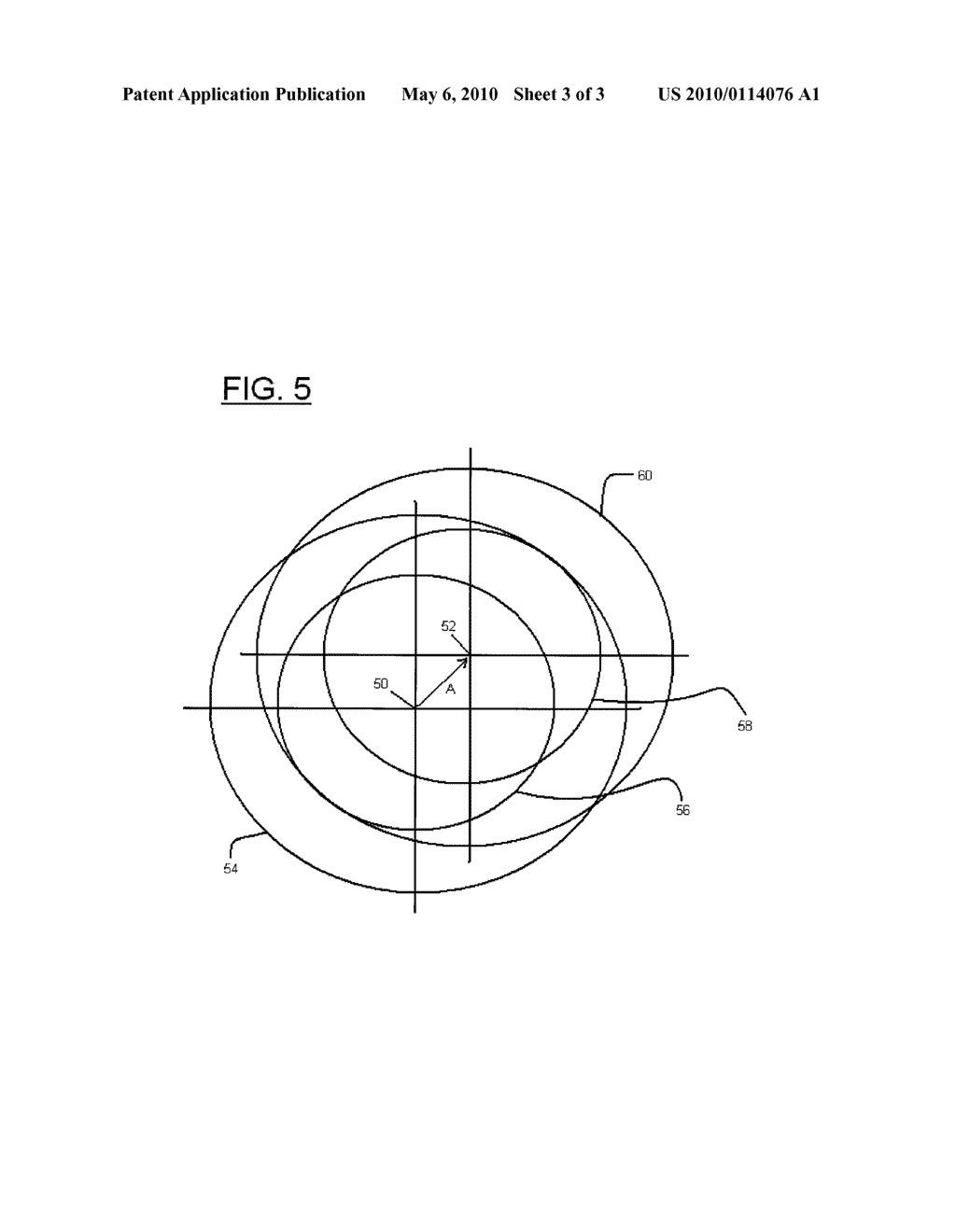 METHOD OF PERFORMING REFRACTIVE LASER EYE SURGERY CENTERED ALONG THE VISUAL AXIS OF A HUMAN EYE - diagram, schematic, and image 04