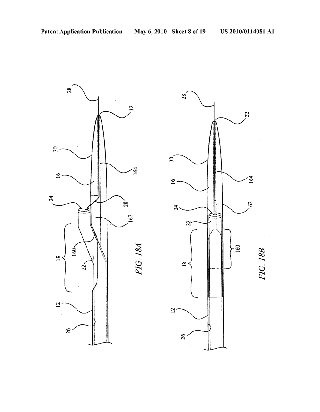 BIASING LASER CATHETER: MONORAIL DESIGN - diagram, schematic, and image 09