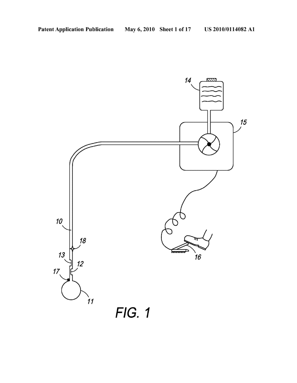 Method and Apparatus for the Ablation of Endometrial Tissue - diagram, schematic, and image 02